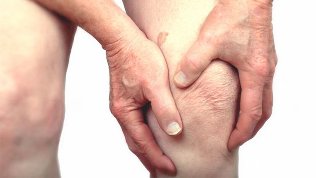 Artritis y artrosis de la articulación de la rodilla. 