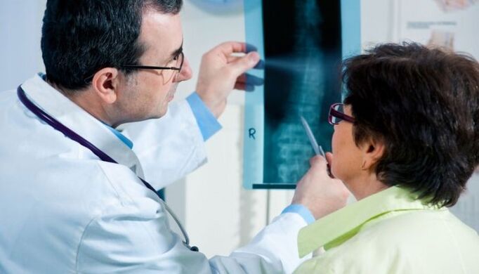 La radiografía como método para diagnosticar la osteocondrosis cervical.
